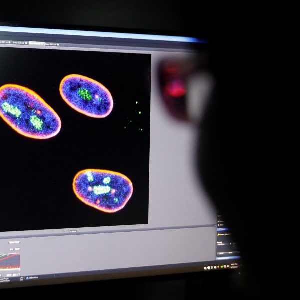 Ending limit on culturing human embryos called ‘affront’ to value of life